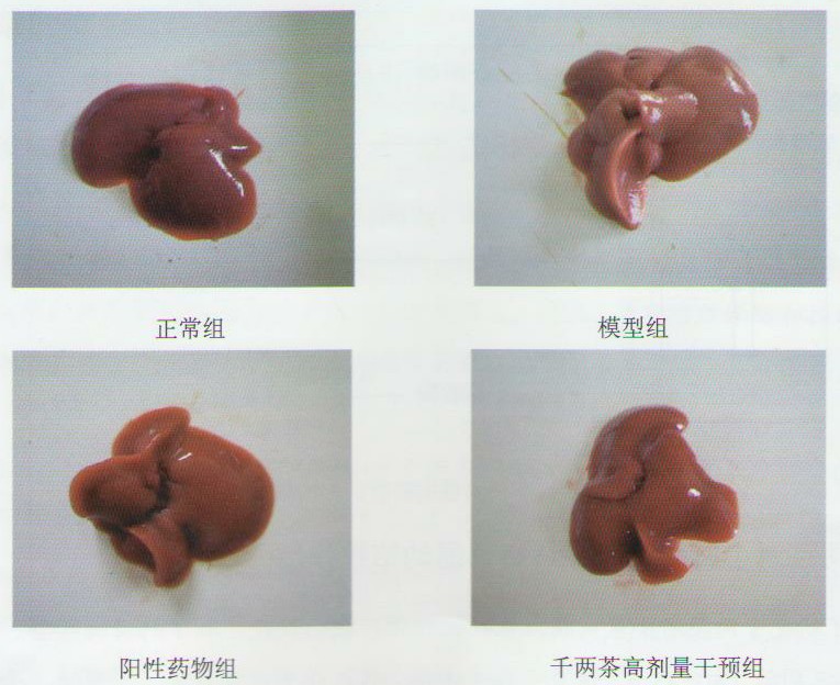 高脂小鼠肝脏对照图